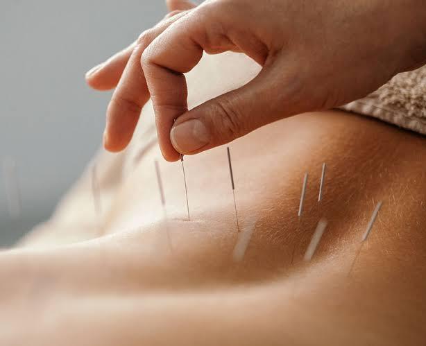 Grandmadisonacupuncture